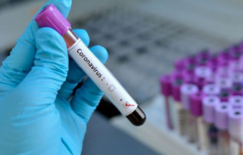 Azərbaycanda koronavirusa ən çox yoluxan rayonlar - SİYAHI